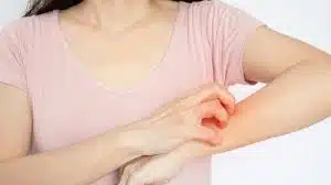 cara mencegah penyakit jamur kucing pada manusia